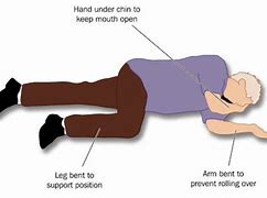 Image result for Diagrams for Putting Someone in Recovery Position