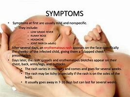 Image result for 5Ths Disease Symptoms