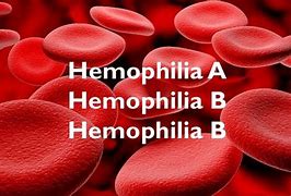 Image result for Difference Between Haemophilia A B and C