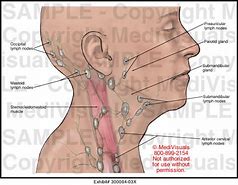 Image result for Location of Lymph Nodes On Head