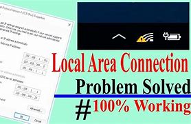 Image result for Local Area Connection