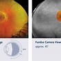 Image result for Retina Drawing Diagram Chart