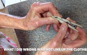 Image result for Clothes Pin On Skin