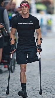 Image result for Guys with Prosthetic Leg