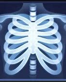 Image result for X-ray Emoji iPhone