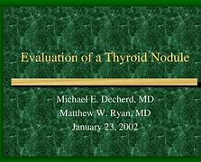 Image result for 1 Cm Thyroid Nodule