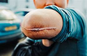 Image result for The Elbow Man Scary