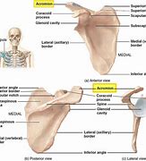 Image result for acromuon