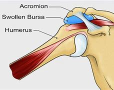 Image result for acromianl