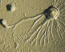 Image result for Dictyostelium Under Microscope