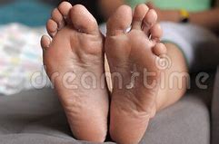 Image result for Foot Skin Renewal