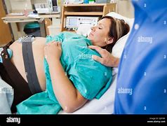 Image result for Intrauterine Fetal Death Anencephaly