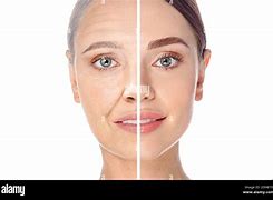 Image result for Woman Face Aging Skin