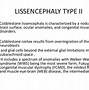 Image result for Lissencephaly Type 1