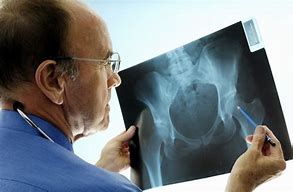 Image result for Orthopedic Surgeon Doctor