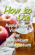Image result for Molluscum Contagiosum Apple Cider Vinegar