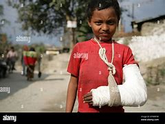 Image result for Boy in Cast and Arm in Sling