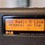 Image result for AM/FM Radio Kit