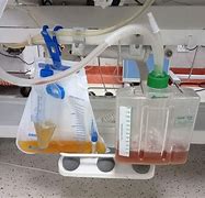 Image result for Patient with Chest Tube Drainage