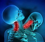 Image result for Assaulted by Chiropractor