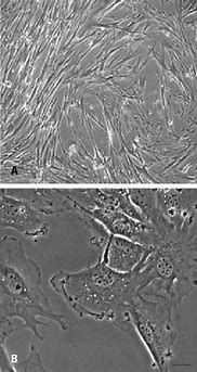Image result for Umbilical Cord Mesenchymal Stem Cells