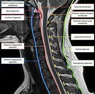 Image result for Cervical Vertebrae C1 C7