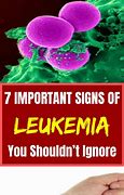 Image result for Signs of Leukemia