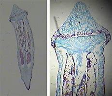 Image result for Moss Capsule Sporangium