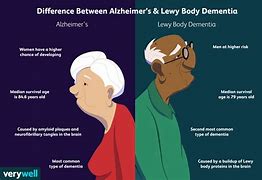 Image result for Dementia vs Alzheimer's Symptoms