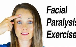 Image result for Bell's Palsy Face Exercises