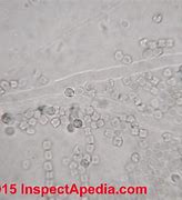 Image result for What Does Toxic Black Mold Look Like