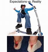 Image result for Broken Leg Scooter Meme