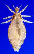 Image result for Body Louse