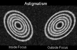 Image result for What Is Astigmatism