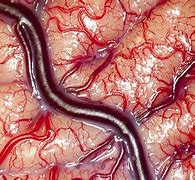 Image result for Inside a Real Human Brain