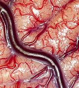 Image result for Real Life Human Brain