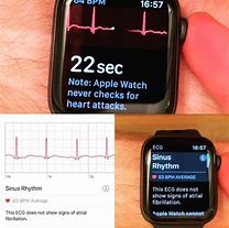Image result for Low Voltage ECG Apple Watch