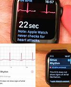 Image result for Apple Watch Series 9 EKG
