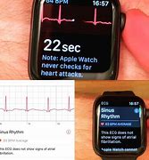 Image result for Apple Watch 5 ECG