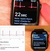 Image result for Apple Watch 5 EKG
