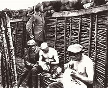 Image result for Trench Lice
