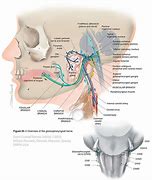 Image result for 9th Cranial Nerve