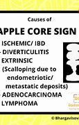 Image result for Apple Core Sign