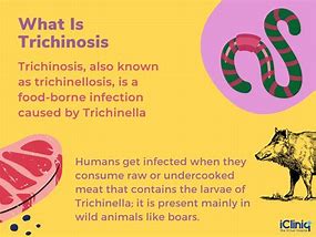 Image result for Trichinosis