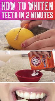 Image result for Teeth Whitening Home Remedy