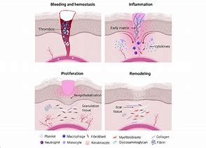 Image result for Cell Wound Healing