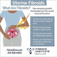 Image result for Uterine Fibroid Tumors Symptoms