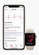Image result for Apple Watch ECG WPO