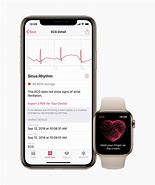 Image result for ECG On Apple Watch
