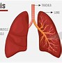 Image result for Cystic Fibrosis Symptoms